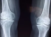 子供の足が痛い！足裏・付け根・足首・膝部分別痛みの原因と対処法